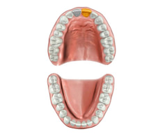 Digital smile design and treatment planning
