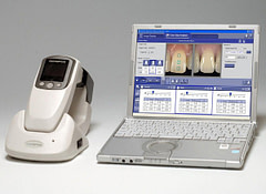 shade_matching_dentistry_idd4