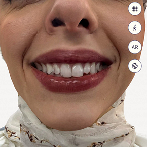 iphone_face_scanning_iDD (1)