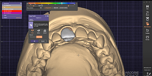What is exocad? A Comprehensive Overview - Institute of Digital Dentistry
