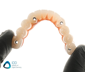 Full arch restoration