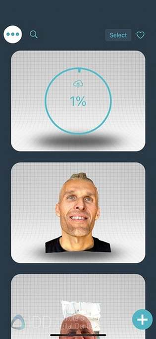 qlone_dental_app_face_scanning_Ray_metismile6