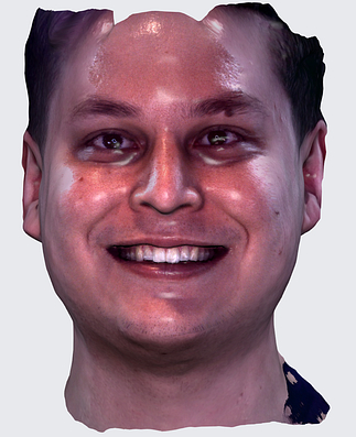 face scan comparison ply stl rayface dental (2)