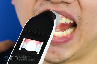 borea_cobra_shade_matching_dentistry_Dental Spectrophotometers and Shade-Matching_iDD19