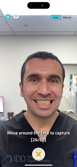 qlone_dental_app_face_scanning_Ray_metismile5
