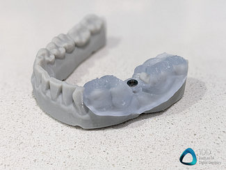 HeyGears UltraCraft Chairside 3D dental printer review (16)