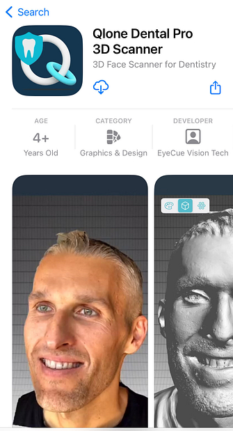 qlone-dental-pro-iphone-app-store-idd-institute-of-digital-dentistry-blog