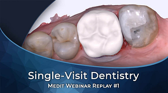 Webinar-01-Single-Visit-Dentistry-free-ce-cpd-online-course-institute-of-digital-dentistry