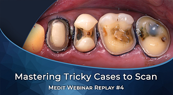 Medit Webinar 04 Mastering Tricky Cases to Scan V2
