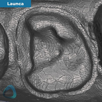 tooth-preparation-scan-with-launca-dl-206p