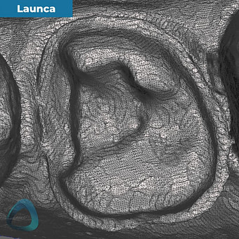 tooth-preparation-scan-with-launca-dl-206p