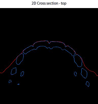 face scan intraoral scanner alignment (1)