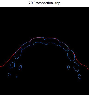 face scan intraoral scanner alignment (1)