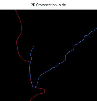 face scan intraoral scanner alignment (3)