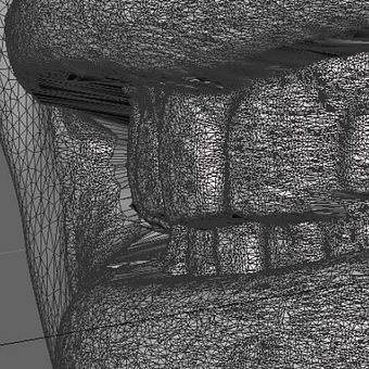 face scan intraoral scanner alignment (2) ray face