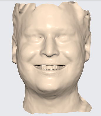 face scan comparison ply stl rayface dental (1)