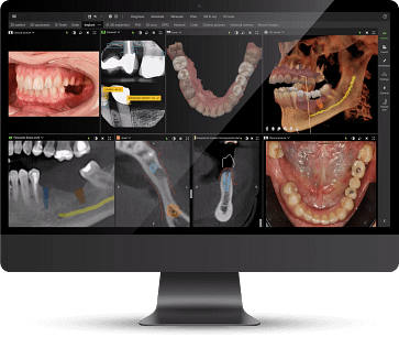 dexis-dtx-studio-idd-digital-dentistry-decoded-podcast-jordan-reiss