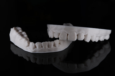 Renfert Simplex Let’s talk about Filament Printers… (FDM)