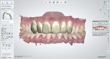 3shape-intraoral-scan-trios-software-idd-institute-of-digital-dentistry-blog