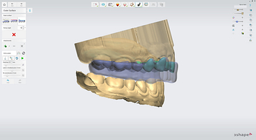 3shape-intraoral-trios-scan-bite-splint-idd-institute-of-digital-dentistry-blog-byron-park-splint-studio-design