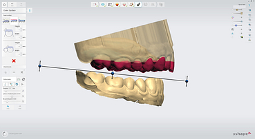 3shape-intraoral-trios-scan-bite-splint-idd-institute-of-digital-dentistry-blog-byron-park-splint-studio-raise-outer-surface