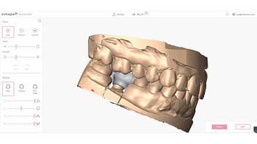 3shape-trios-5-intraoral-scanner-review-automate-coping-pfm-crown-cad-design-idd-digital-dentistry