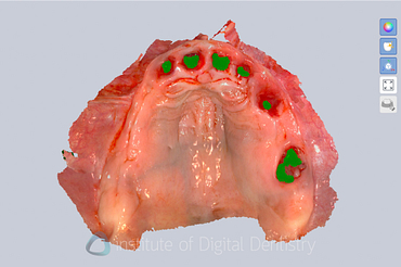 alliedstar_sensa_intraoral_scanner_review_iDD (12)