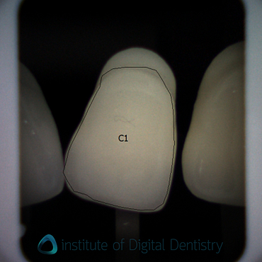 shade_guide_test_borea2