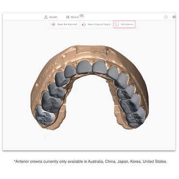 3shape-trios-5-intraoral-scanner-review-automate-crown-ai-anterior-cad-design-idd-digital-dentistry