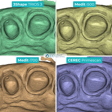 idd-compares-intraoral-scanners-3shape-trios3-medit-i500-i700-dentsply-sirona-cerec-primescan-tessellated-mesh