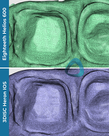 idd-compares-intraoral-scanners-helios-600-eighteeth-3disc-heron-ios-tessellated-mesh