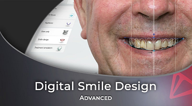 Advanced Applications of a Digital Smile Design