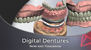 Digital Dentures Now and Tomorrow