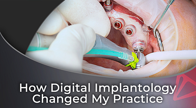 How Digital Implantology Changed My Practice