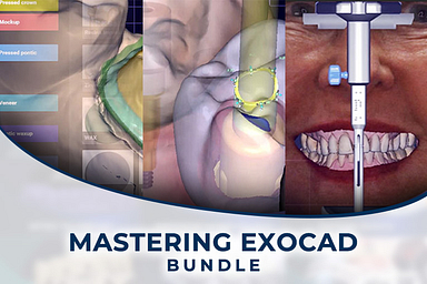 Mastering-exocad-bundle-spiffy-765x510