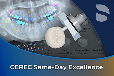 CEREC Same-Day Excellence Cart Thumbnail 765x510