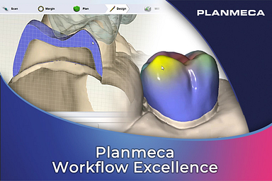 Planmeca Workflow Excellence Cart Thumbnail 765x510