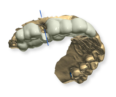 iDD Guided Dental Surgery