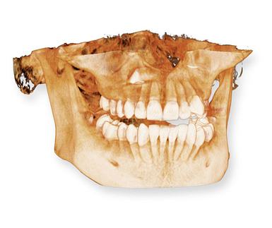 cbct Digital Imaging & Diagnosis