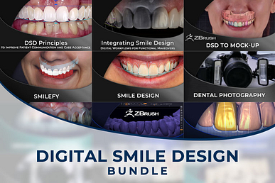 digital-smile-design-DSD-bundle-spiffy-765x510
