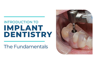 Introduction-to-Implant-Dentistry-Thumbnail-765x510 Introduction to Implant Dentistry Course Thumbnail
