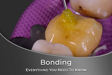 Bonding-Cart-Thumbnail-765x510