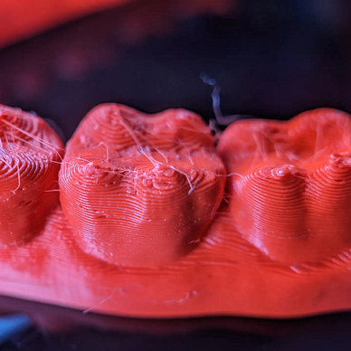 FDM printer dental model (2)