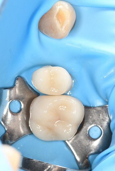 Byron Park 24 Implant 3Shape 4