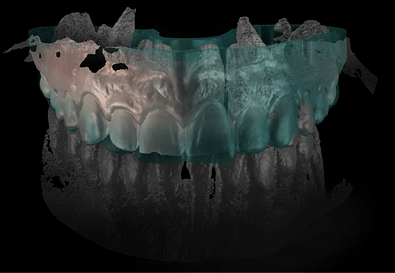 smilecloud-smile-design-ai