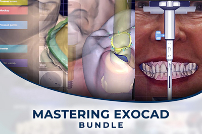 Mastering-exocad-bundle-spiffy-765x510