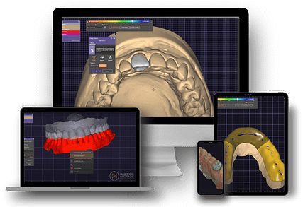 exocad mock up