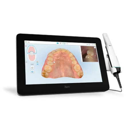 iTero Lumina Now Available as a PC Configuration Scanner | iDD