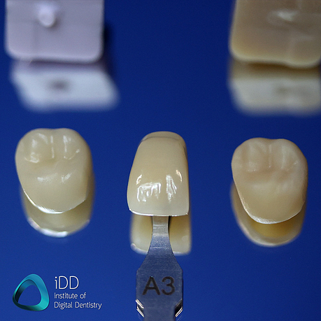CEREC Tessera vs e.max CAD by Ivoclar Vivadent Institute of Digital Dentistry (4)