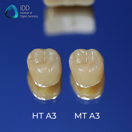 CEREC Tessera vs e.max CAD by Ivoclar Vivadent Institute of Digital Dentistry (6)